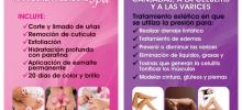 Piernas cansadas y varices