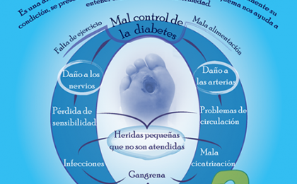 pie diabético